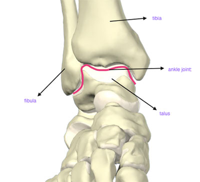 Ankle Arthritis